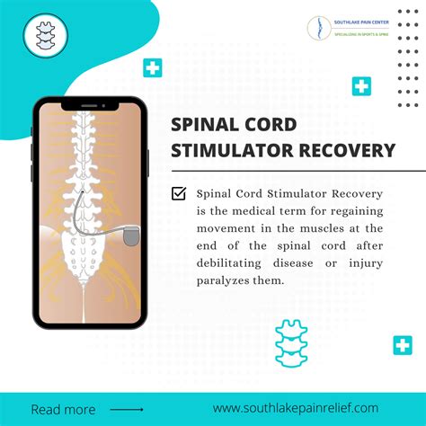 Spinal cord stimulator Benefits, Procedure and Treatment in Southlake, Tx – South Lake Pain ...