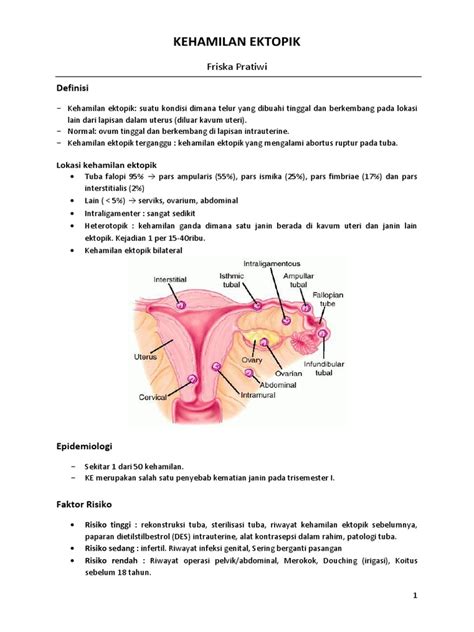 Kehamilan Ektopik