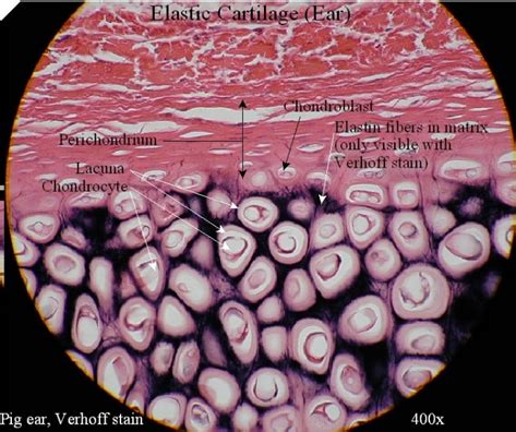 Elastic Cartilage Epiglottis Labeled