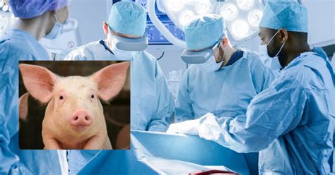 Medical Marvel: Pig To Human Organ Transplant Creates New History