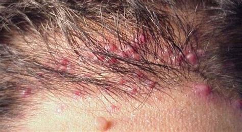 Pin on Skin Problem