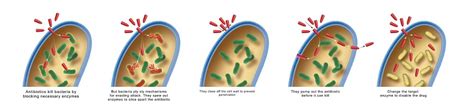 Yersinia Pestis - The Definitive Guide | Biology Dictionary