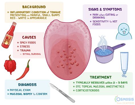 Transient Lingual Papillitis: What Is It, Causes, Symptoms, and More | Osmosis