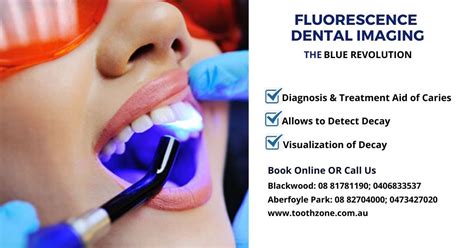 Tooth Zone offers the best Dental Caries Diagnosis using Fluorescence ...