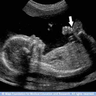 Slide show: Fetal ultrasound | Ultrasound, Baby ultrasound, Fetal