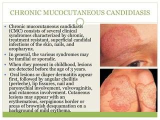 Candidiasis