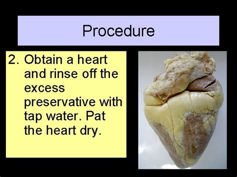 HEART DISSECTION LAB Procedure 1 Obtain a dissection