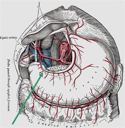 The Pump and the Tubes: Right Gastric Artery