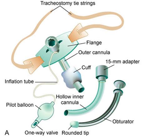 Tracheostomy tube components Flashcards | Quizlet