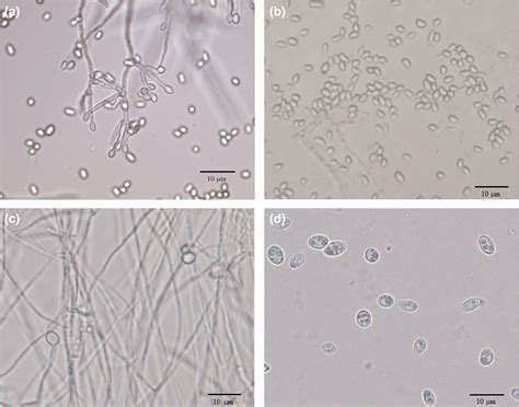 Identification of genes related to chlamydospore formation in Clonostachys rosea 67‐1 - Sun ...