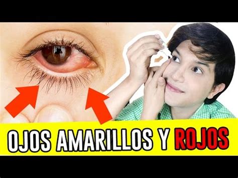 Estoy orgulloso Preguntar aluminio ojos rojos amarillentos Acelerar Violeta Unir