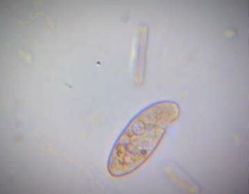 The Picture of Tetrahymena sp under the microscope with enlarge 40 x 10 ...