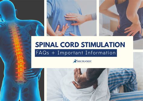 Spinal Cord Stimulator: FAQs + Important Info