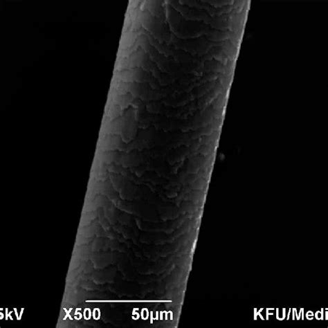 (PDF) Scanning Electron Microscopy Study of Hair Shaft Damage Secondary to Cosmetic Treatments ...