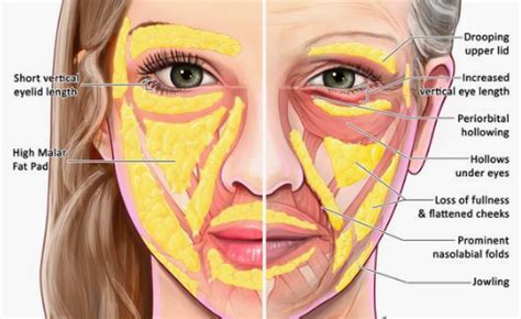 Ageing of the Face | Faciem Dermatology Clinic