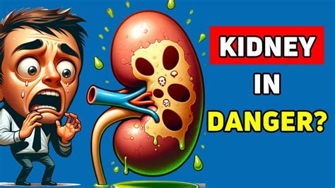 BEST 10 Foods To DETOX and CLEANSE Your Kidneys Naturally - YouTube