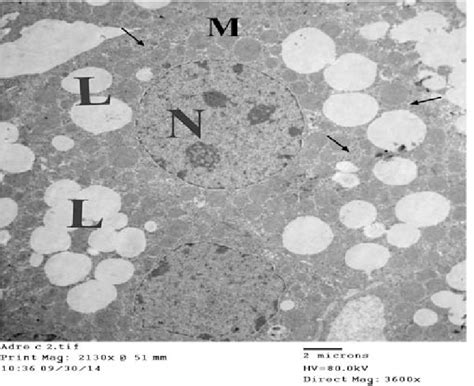 An electron micrograph of a zona fasciculata cell from the control... | Download Scientific Diagram