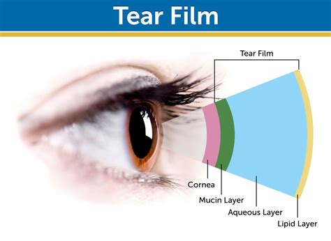 Tear Film Exchange: Just One More Reason RGP Contact Lenses May Be A Better Choice - Eyedolatry