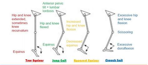 Adult Spastic Cerebral Palsy: A Case Study with Anterior Knee Pain - Physiopedia