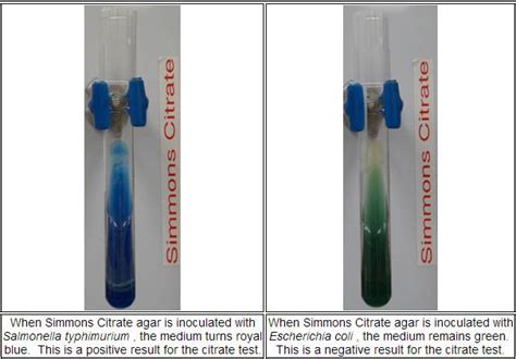 Simmons Citrate Agar | Medical Laboratories