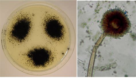 Aspergillus Niger Structure