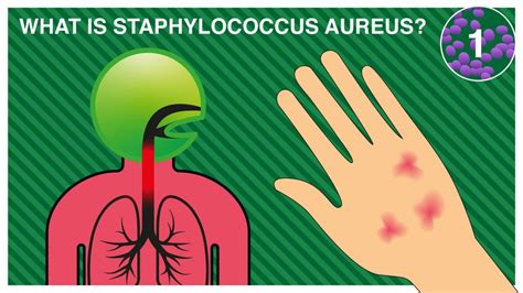 STAPHYLOCOCCUS AUREUS - Pal International