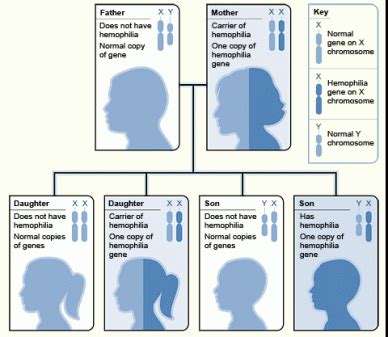 Hemophilia - Gene Location