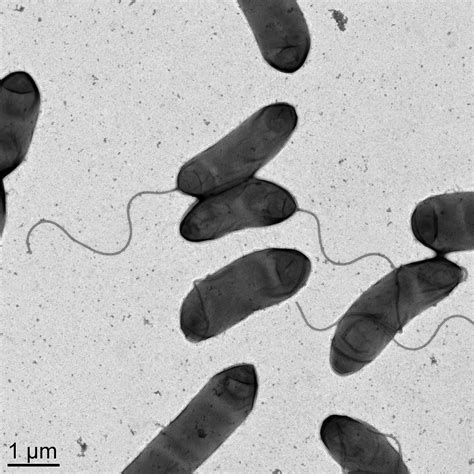 An unusual form of antibiotic resistance in pandemic cholera | EurekAlert! Science News