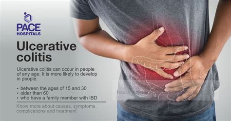 Ulcerative colitis: causes, symptoms, complications and treatment