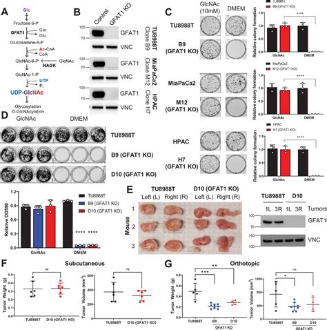 Hyaluronic acid fuels pancreatic cancer cell growth | eLife