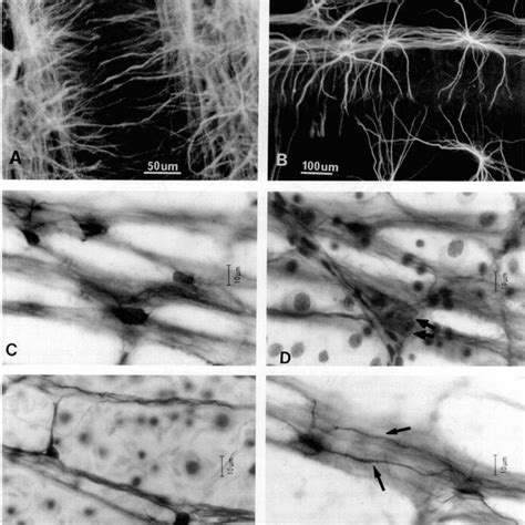 A,B. Show the same area of retina, A showing the astrocytes visualised ...