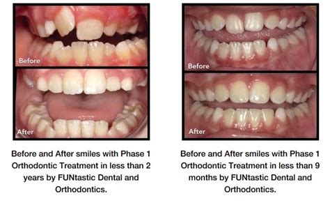 Family Orthodontics | Childrens Braces | FUNtastic Dental