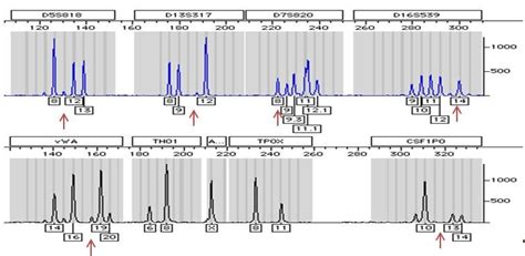 Figure 18. [Electropherogram of Cellular Cross-contamination. Multiple...]. - Assay Guidance ...