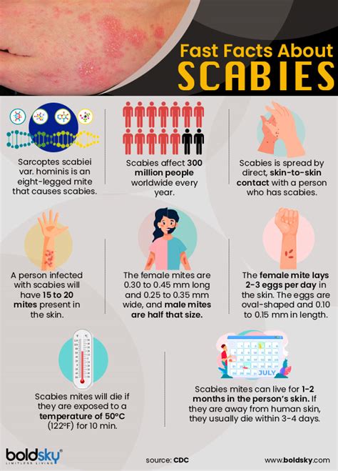 Scabies: Causes, Transmission, Symptoms, Diagnosis, Treatment And ...