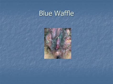 Blue Waffle | Public Health