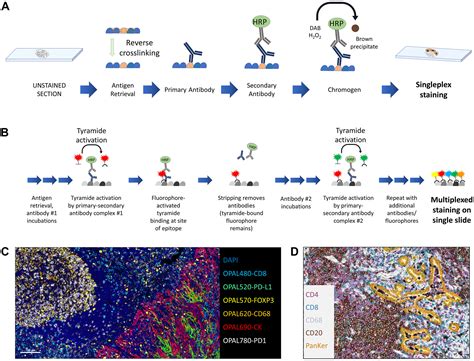 Multiplex Immunohistochemistry and Immunofluorescence: A Practical ...