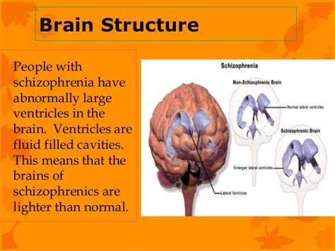 Schizophrenia