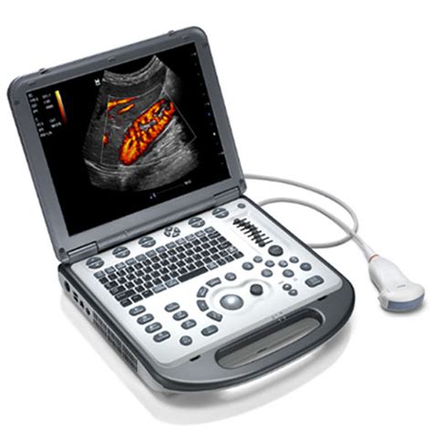 Mindray M6 Ultrasound Machine Details | National Ultrasound