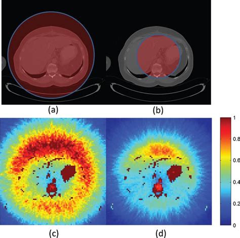 Clinical validation of CT image reconstruction with interior tomography - IOS Press