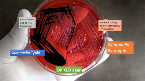 Salmonella Typhi Blood : Typhoid Fever Causes Symptoms Vaccine Summit ...