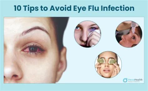 10 Easy Eye Flu Prevention Tips: Keep Your Eyes Healthy