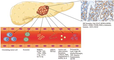 The role of biomarker in pancreatic neuroendocrine tumor: a narrative review | Journal of ...