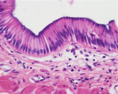 Simple Columnar Epithelium Cells