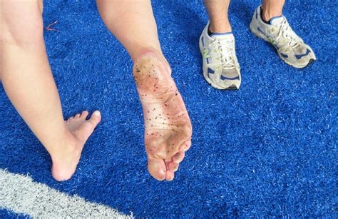 Barefoot Runner Blisters the Track in the Barber to Boise 2011