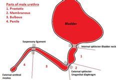 Urinary Tract and male reproductive system | 2.2 Bladder : Case 2.2.1 Bladder tumors ...