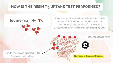 T3 Resin Uptake (T3RU) : A Detailed Guide - My Endo Consult