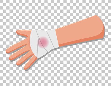 Injury arms with gauze on transparent background 1782979 Vector Art at ...