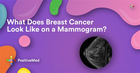 What Does Breast Cancer Look Like on a Mammogram - PositiveMed