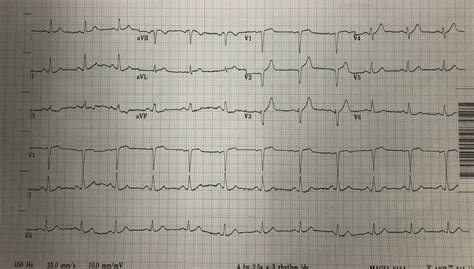 Dr. Smith's ECG Blog