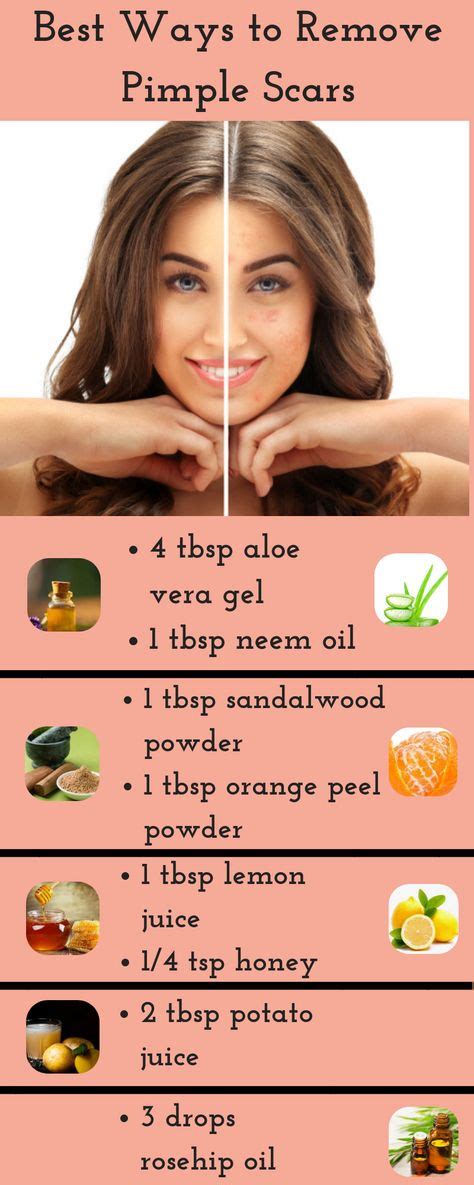 25+ bästa Pimples remedies idéerna på Pinterest